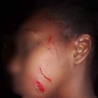  Usando una hoja para afeitar, la sospechosa le propinó cuatro cortes en el rostro de la menor. 