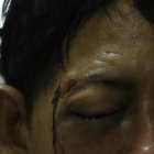  Carlos esperaba el turno de reconocimiento médico para que le den una boleta de auxilio. 