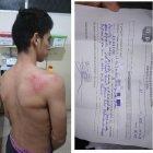  El joven afectado por el golpe en la cabeza se recupera de sus lesiones. 