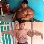  El chico enfrenta otro problema: el del exceso de piel con el que quedó tras la enorme pérdida de peso, el que se evidencia sobre todo en sus brazos y pecho. 