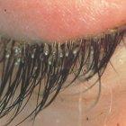  Especialistas advierten que la mala higiene en esta zona puede crear el ambiente ideal para que tengas piojos.  