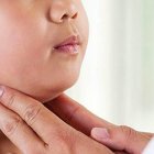  Referencial. El MSP ha brindado a la ciudadanía una serie de recomendaciones para prevenir y controlar la enfermedad, luego de una reciente brote en escuelas de Quito. 