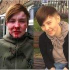  Ellie-Mae fue agredida por dos supuestas amigas que la dejaron con graves heridas en el rostro 