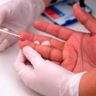  Pese a los avances en el tratamiento, la falta de acceso a los servicios de salud, el estigma, la discriminación y la creciente migración se mantienen como los principales desafíos para la región.  