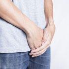  Las enfermedades del pene están asociadas con una mala higiene.  