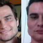  Fotos de Alexandre Garzón en un antes y después de una excesiva dosis de polimetilmetacrilato que deformaron su rostro. 