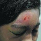  El niño tiene laceraciones en la cabeza, cadera, brazos y piernas.  