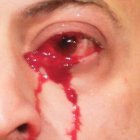  Su caso parece de ficción pero se trata de una extraña condición médica. 