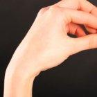  Referencial. La más conocida de estas píldoras se denomina Ella. En muchos países hay que acercarse con una prescripción médica para poder conseguirla.  