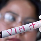  De acuerdo a datos de ONUSIDA, en el país se estimó que, para el cierre del 2017, existían 36.544 personas que viven con VIH.  