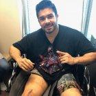  La cicatriz de su rodilla es pronunciada.  