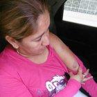  Alexis Magallanes Hidalgo muestra los moretones tras la agresión de su expareja 