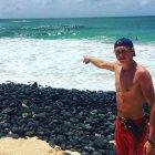  El joven Dylan McWilliams en la playa hawaiana donde fue mordido por un tiburón. 