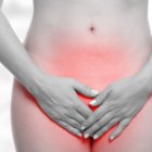  Foto de referencia. Las mujeres de 20 a 50 años, deberían realizarse un chequeo integral ginecológico a fin de prevenir las infecciones vaginales. 