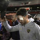  Luego de los incidentes Pablo Pérez tuvo que ponerse un parche para proteger su ojo.  