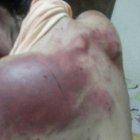  La mujer presenta golpes en la espalda, rostro y cabeza. Además heridas de cuchillo. 