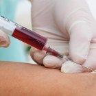  Entre 200 a 300 personas atienden los centros de salud para hacerles los exámenes.  