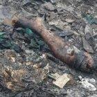  La pierna humana causó pánico al ‘chambero ‘ que se disponía recolectar materiales reciclables. 