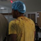  El sospechoso de 29 años, Jorge Martínez, fue agredido por el presunto abuso sexual en contra de su hijastra. Presenta tres cortes en la cabeza. 