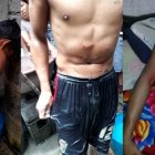  La heridas causadas por los canes. 