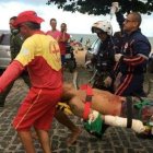  La pierna del hombre tuvo que ser amputada luego del ataque. 