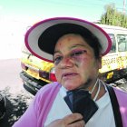 A Mayra Troya le desfiguraron el rostro por pedir respeto al toque de 
queda.