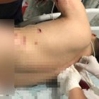 Los perdigones impactaron en la espalda del agente.