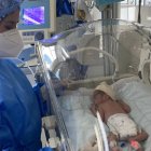 Los gemelos recibirán cuidados especiales durante un mes.