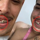 La historia de Thomas Dosher es la de un hombre que consiguió la fama por pedir un diente.