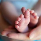 El 'bebé sin rostro' cumplió un año de vida, pese a todos los pronósticos médicos.