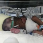 Estuvo 43 días en la Unidad de Cuidados Intensivos y nació con un peso de 1.200 gramos.