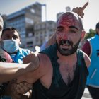 Un hincha ensangrentado en el adiós de Diego Maradona.