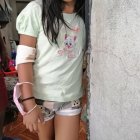 Una niña, de 9 años, resultó con una herida leve en un brazo.