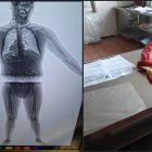 La verificación con rayos X permitió descubrir la droga