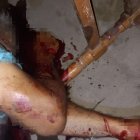 El cadáver fue trasladado hasta el Centro Forense de Manta.