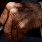 La señora luchó por comer sus alimentos pero se atragantó.