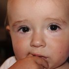 Problemas respiratorios, ronquidos, dificultad para deletrear, entre otras serían las consecuencias de una prolongada succión.