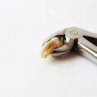 Se recomienda acudir al odontólogo ante la presencia de algún síntoma y proceder a su extracción temprana, para evitar mayores problemas y la pérdida de no solo el tercer molar sino de otra pieza.