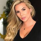 Carolina Jaume tiene psoriasis.