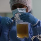 Con el suero se espera ayudar a los casos moderados y severos de coronavirus.