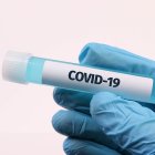 Posible fármaco podría contrarrestar al covid-19.