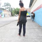 Julissa se tiene que poner un buzo en su cintura para tapar sus manchas.