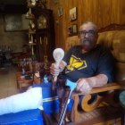 Una fotografía después del accidente del cocinero.