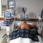 Los pacientes afectados gravemente con Covid-generalmente han sido intubados en las UCI