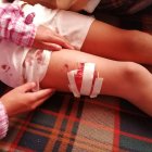 El pequeño Wilson se recupera en casa después de la agresión que sufrió por un perro,