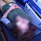 La adulta mayor tiene hematomas en el rostro y fracturadas las costillas.