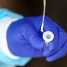 A nivel nacional hay 33.709 fallecimientos por coronavirus.