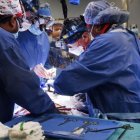 Médicos realizando el complicado pero exitoso transplante.