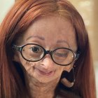 Adalia Rose murió a las 15 años.