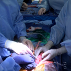 La operación salió exitosa